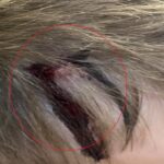 Ударено дете