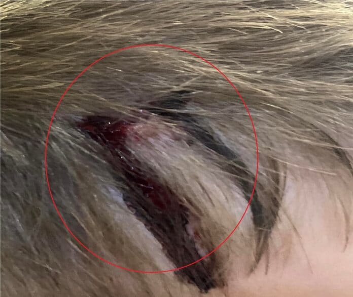 Ударено дете