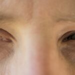 Мнителност, поглед, очи