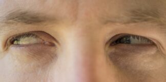 Мнителност, поглед, очи