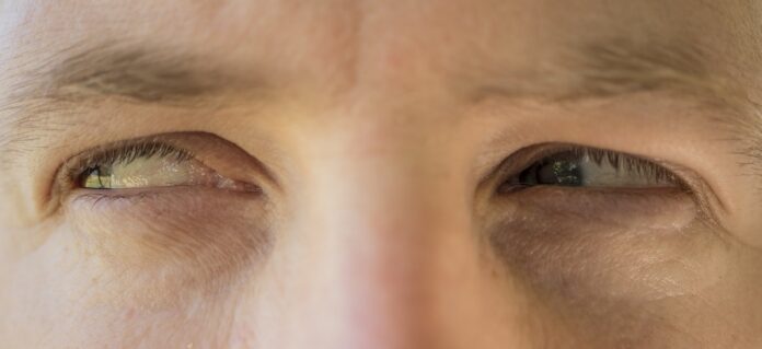 Мнителност, поглед, очи