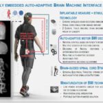 Система за моторна стимулация