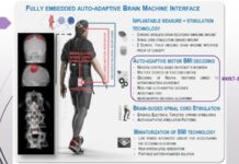 Система за моторна стимулация