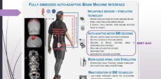 Система за моторна стимулация