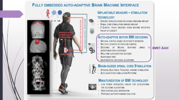 Система за моторна стимулация