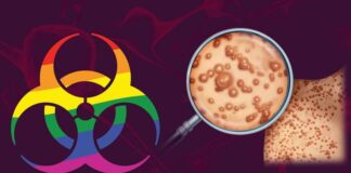 Маймунска шарка