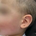 Пострадало дете