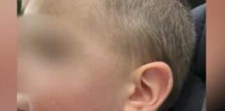 Пострадало дете