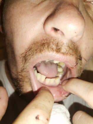 Нападение, Младен Манев