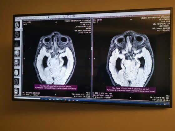 Велинка, рентгенова снимка
