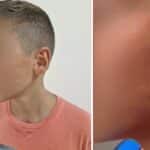 Пострадало дете