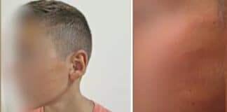 Пострадало дете