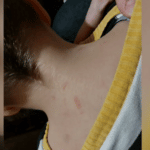 Пострадало дете