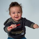 Дете, варицела