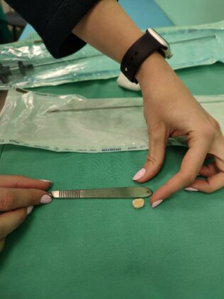 Зъб, УМБАЛ-Бургас