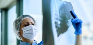 Бели дробове