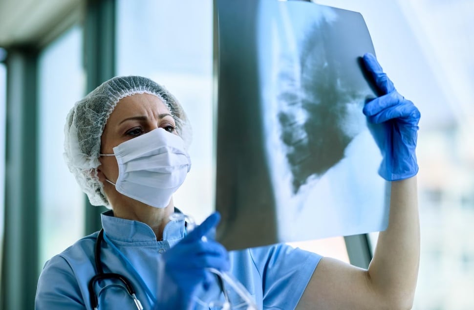 В 12 области у нас заболеваемостта от туберкулоза е над