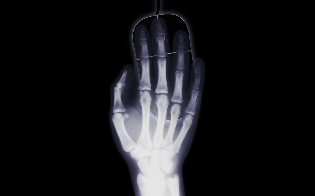 Рентген, ръка