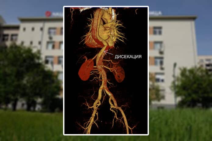 Разкъсана аорта