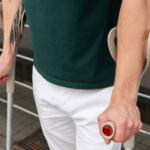 Счупен крак