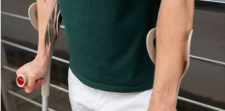 Счупен крак