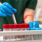 Кръвна проба