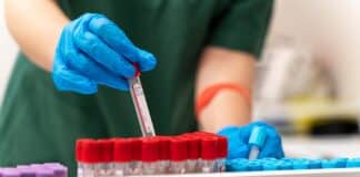 Кръвна проба