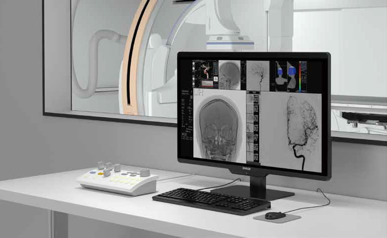 Съвсем скоро УМБАЛ Бургас ще се сдобие с нова ангиографска зала