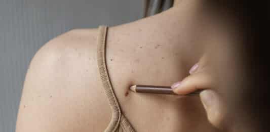 Преглед на пациент