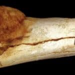 Кост на пръст