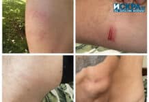 Наранявания