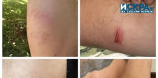 Наранявания