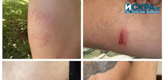 Наранявания