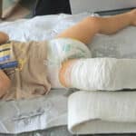 Пострадалото дете