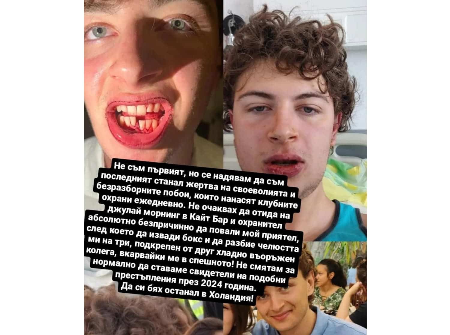 Полицай е счупил челюстта на 19 годишния студент Владимир Радев Информацията