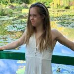 Челси Вернер е със Синдром на Даун