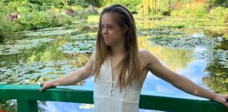 Челси Вернер е със Синдром на Даун