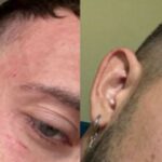 Пребиха мъж заради паркомясто в София