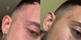 Пребиха мъж заради паркомясто в София