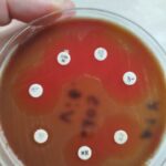 Бактерия човекоядец