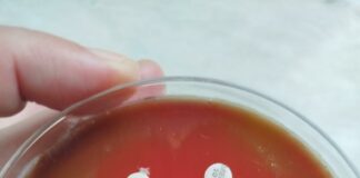 Бактерия човекоядец