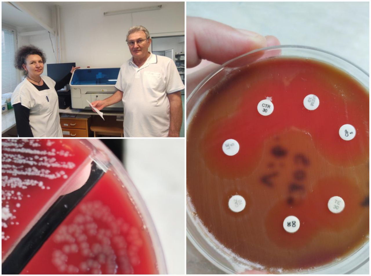 Лекари от УМБАЛ Бургас успешно спасиха живота на 61 годишна жена заразена