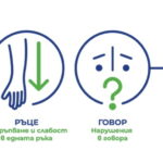 Симптомите на инсулт