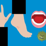 Коксаки вирус