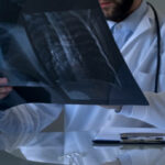 Пневмония, лекар