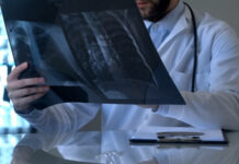 Пневмония, лекар