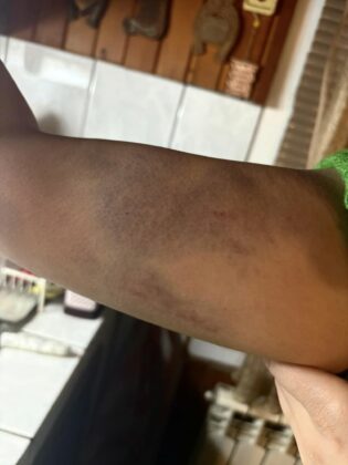 Побой в Годеч