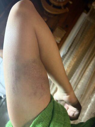 Побой в Годеч