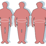 Затлъстяване