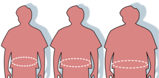 Затлъстяване